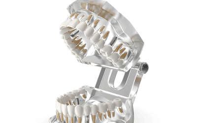 Invisalign vs. Braces: The Future of Complex Orthodontics