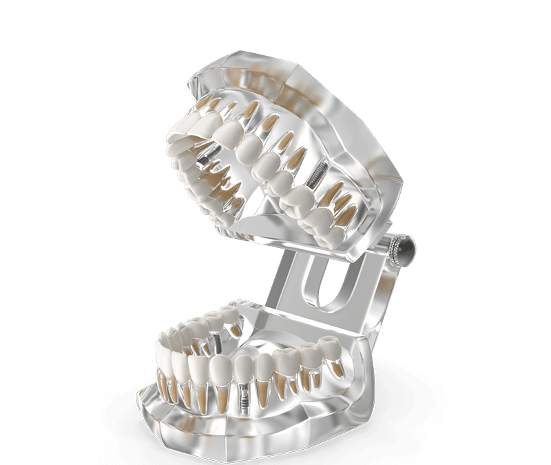 Invisalign