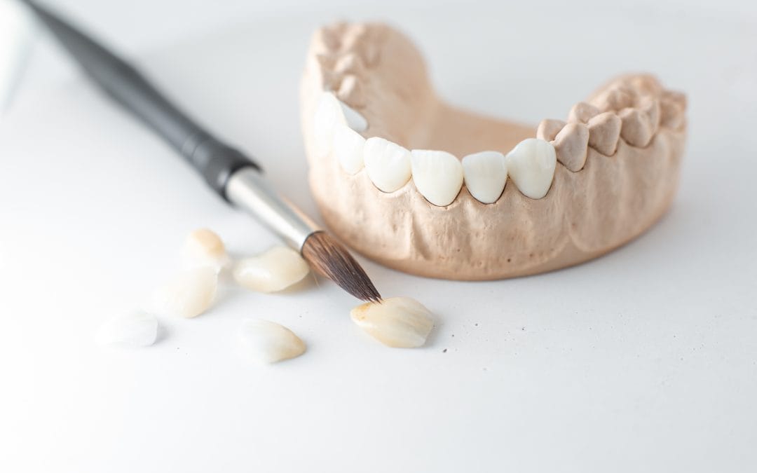Teeth Whitening Costs